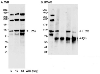 Rabbit TPX2 Antibody