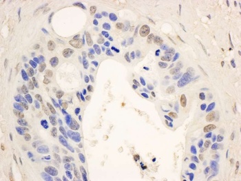 Rabbit STAT6 Antibody