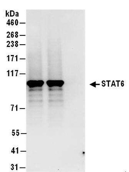 Rabbit STAT6 Antibody