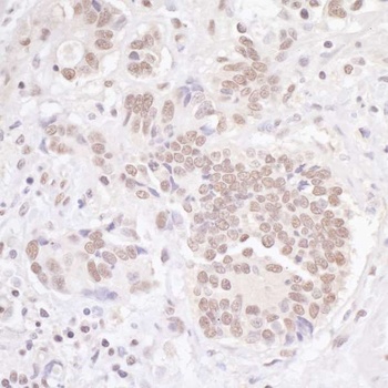 Rabbit TBLR1 Antibody