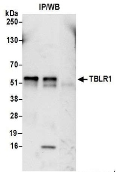 Rabbit TBLR1 Antibody