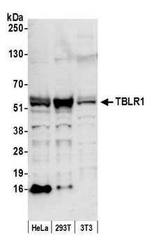 Rabbit TBLR1 Antibody