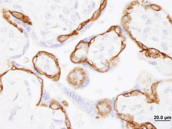 Rabbit EGFR Antibody