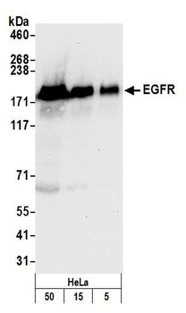 Rabbit EGFR Antibody