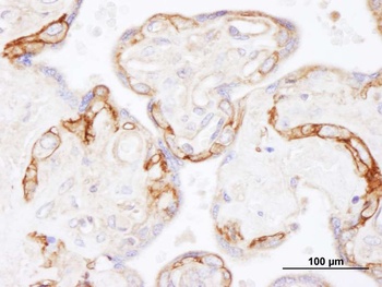 Rabbit EGFR Antibody