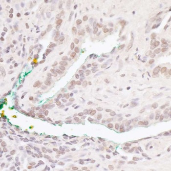 Rabbit Bcl11b Antibody