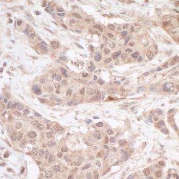 Rabbit FHL2 Antibody