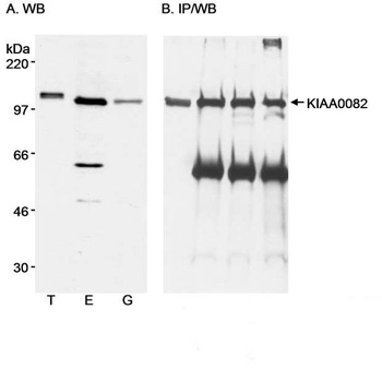 Rabbit KIAA0082 Antibody