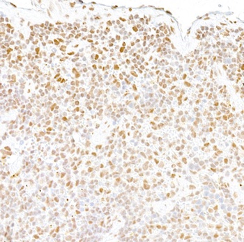 Rabbit FUS Antibody