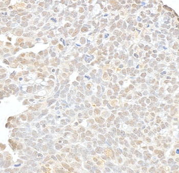 Rabbit hSET1 Antibody