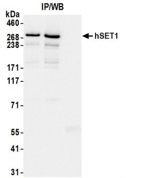 Rabbit hSET1 Antibody