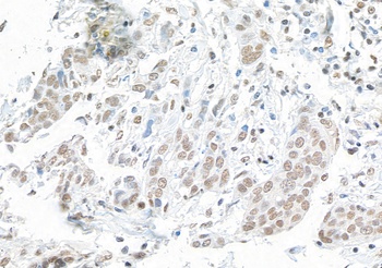 Rabbit SMAR1/BANP Antibody
