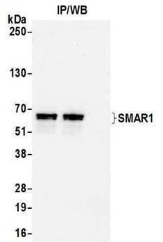 Rabbit SMAR1/BANP Antibody