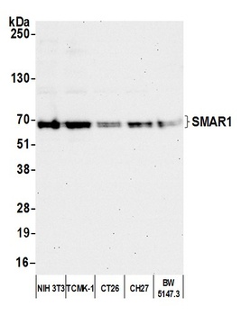 Rabbit SMAR1/BANP Antibody
