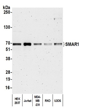 Rabbit SMAR1/BANP Antibody