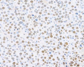 Rabbit PCNA Antibody