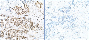 Rabbit Phospho RPA32 (S4/S8) Antibody