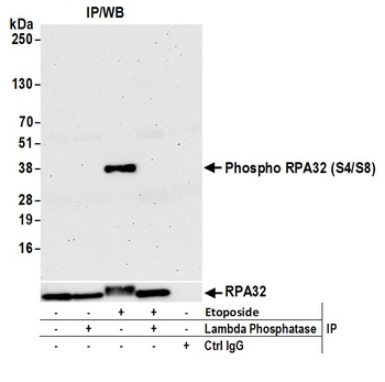 Rabbit Phospho RPA32 (S4/S8) Antibody