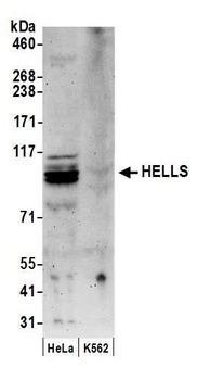 Rabbit HELLS Antibody