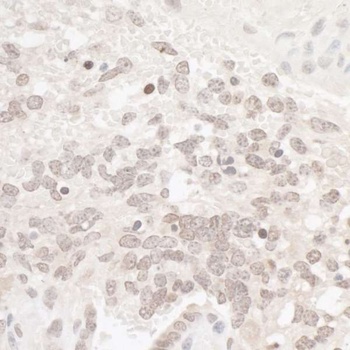 Rabbit CKII alpha Antibody