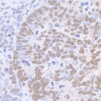 Rabbit Sp1 Antibody