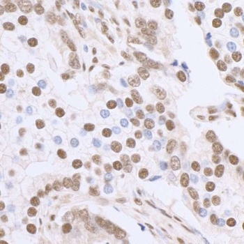 Rabbit Sp1 Antibody