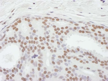 Rabbit ASH2 Antibody