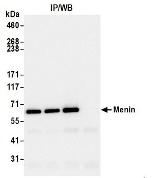 Rabbit Menin Antibody