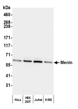 Rabbit Menin Antibody