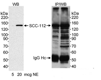 Rabbit SCC-112 Antibody