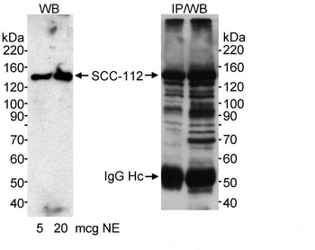 Rabbit SCC-112 Antibody