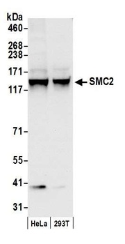 Rabbit SMC2 Antibody