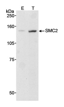 Rabbit SMC2 Antibody