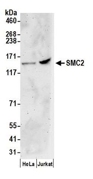 Rabbit SMC2 Antibody