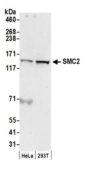 Rabbit SMC2 Antibody