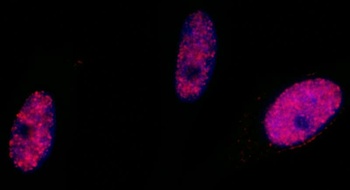 Rabbit Phospho SMC1 (S966) Antibody
