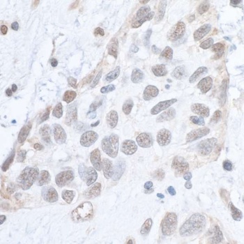 Rabbit Phospho SMC1 (S966) Antibody