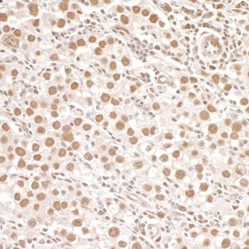 Rabbit Phospho SMC1 (S966) Antibody