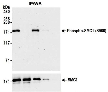 Rabbit Phospho SMC1 (S966) Antibody
