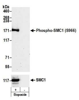 Rabbit Phospho SMC1 (S966) Antibody
