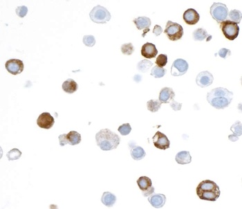 Rabbit V5 Tag Recombinant Monoclonal Antibody