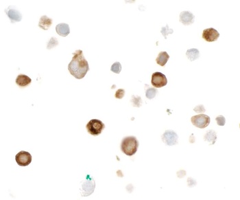 Rabbit HA Tag Recombinant Monoclonal Antibody