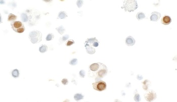 Rabbit HA Tag Recombinant Monoclonal Antibody