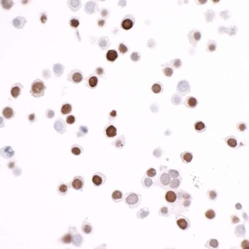 Rabbit ECS (DYKDDDDK) Tag Recombinant Monoclonal Antibody