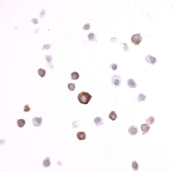 Rabbit ECS (DYKDDDDK) Tag Recombinant Monoclonal Antibody