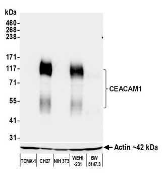 Rabbit CEACAM1 Recombinant Monoclonal Antibody