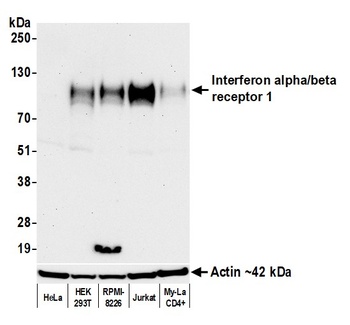 Rabbit Interferon alpha/ beta receptor 1 Recombinant Monoclonal Antibody
