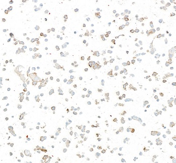 Rabbit LOX-1 Recombinant Monoclonal Antibody