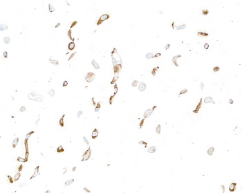 Rabbit LOX-1 Recombinant Monoclonal Antibody