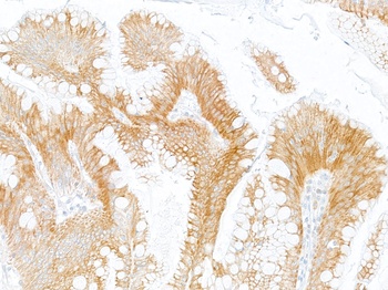 Rabbit LOX-1 Recombinant Monoclonal Antibody